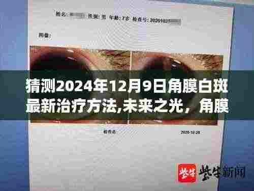 未来之光，角膜白斑新疗法的探索与自我超越之旅——预测至2024年12月9日的最新治疗方法