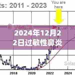 过敏性鼻炎患者的冬日特殊发热门诊之旅，喷嚏与温情交织的2024年12月22日