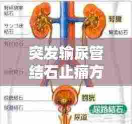 突发输尿管结石止痛方法：输尿管结石突发怎么办 