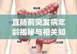 直肠前突发病年龄揭秘与相关知识深度解析
