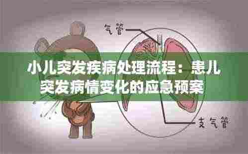 小儿突发疾病处理流程：患儿突发病情变化的应急预案 
