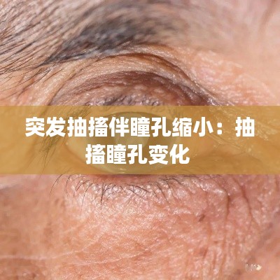 突发抽搐伴瞳孔缩小：抽搐瞳孔变化 