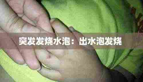 突发发烧水泡：出水泡发烧 