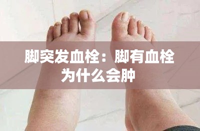 脚突发血栓：脚有血栓为什么会肿 