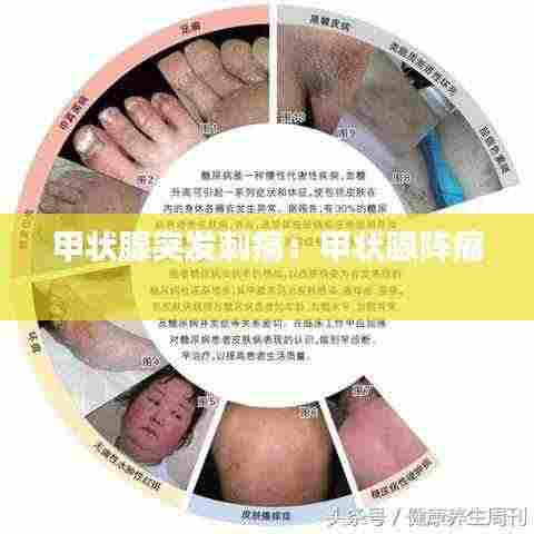 甲状腺突发刺痛：甲状腺阵痛 