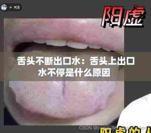 舌头不断出口水：舌头上出口水不停是什么原因 
