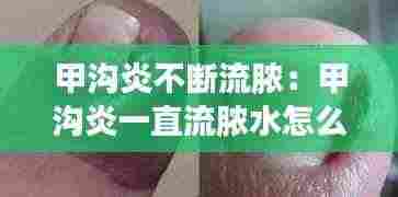 甲沟炎不断流脓：甲沟炎一直流脓水怎么办 