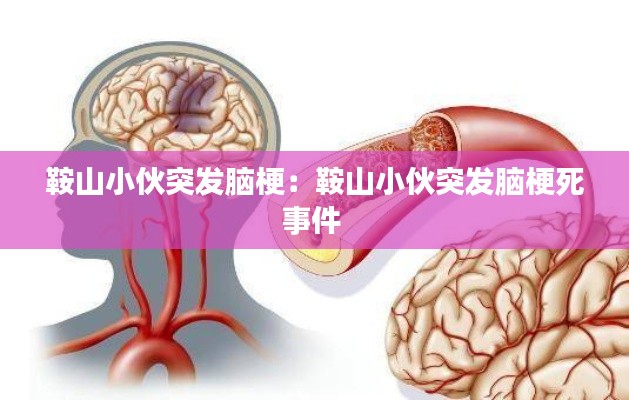 鞍山小伙突发脑梗：鞍山小伙突发脑梗死事件 