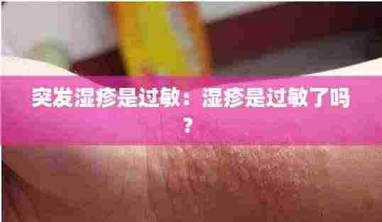 突发湿疹是过敏：湿疹是过敏了吗? 