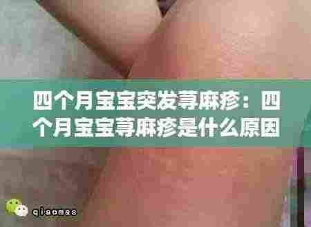 四个月宝宝突发荨麻疹：四个月宝宝荨麻疹是什么原因引起的 