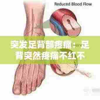 突发足背部疼痛：足背突然疼痛不红不肿 