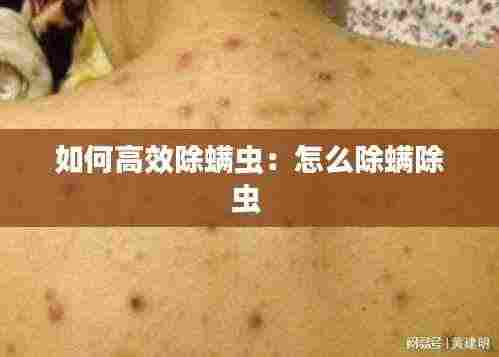 如何高效除螨虫：怎么除螨除虫 