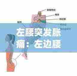 左腰突发胀痛：左边腰突出腰疼怎么办 