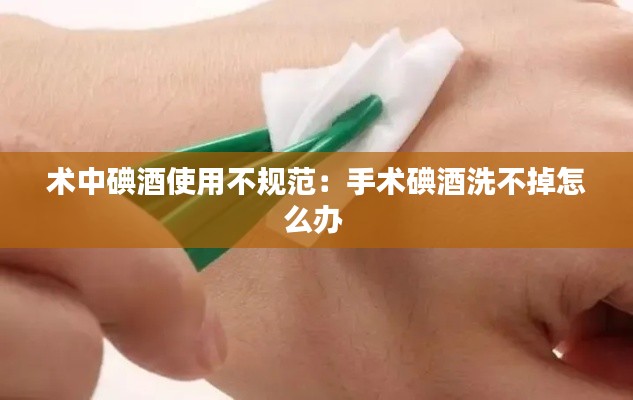 术中碘酒使用不规范：手术碘酒洗不掉怎么办 