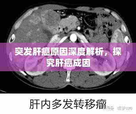突发肝癌原因深度解析，探究肝癌成因