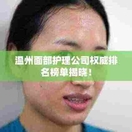 温州面部护理公司权威排名榜单揭晓！