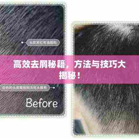 高效去屑秘籍，方法与技巧大揭秘！