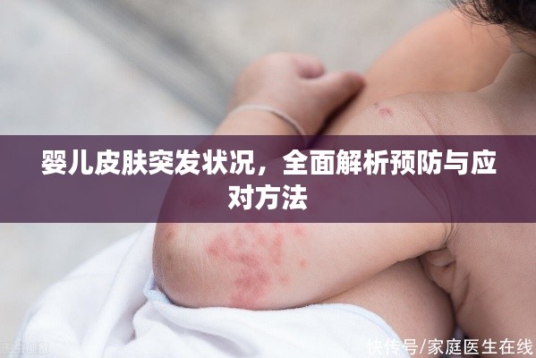 婴儿皮肤突发状况，全面解析预防与应对方法