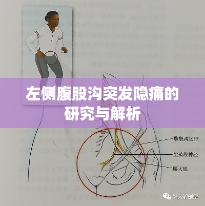 左侧腹股沟突发隐痛的研究与解析