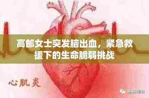 高邮女士突发脑出血，紧急救援下的生命脆弱挑战