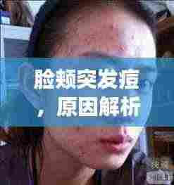 脸颊突发痘，原因解析、预防策略及应对妙招