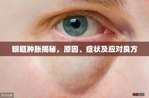 眼眶肿胀揭秘，原因、症状及应对良方