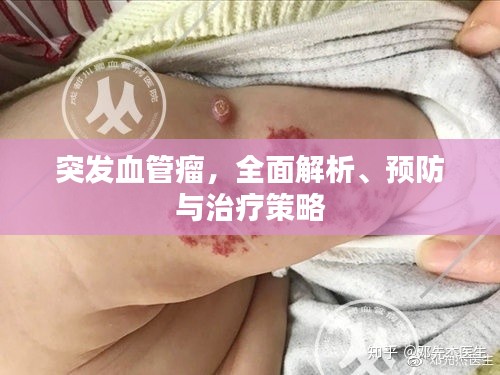突发血管瘤，全面解析、预防与治疗策略