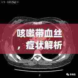 咳嗽带血丝，症状解析、诱因探究及有效治疗策略